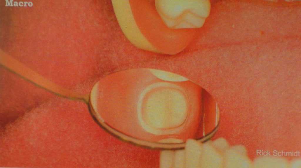 森川精密|左下后牙区的工作体位及口镜使用技巧 - 显微讲堂 - 10
