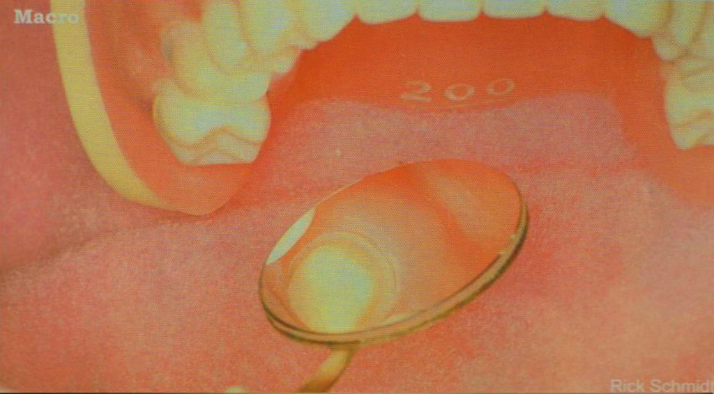 森川精密|左下后牙区的工作体位及口镜使用技巧 - 显微讲堂 - 20