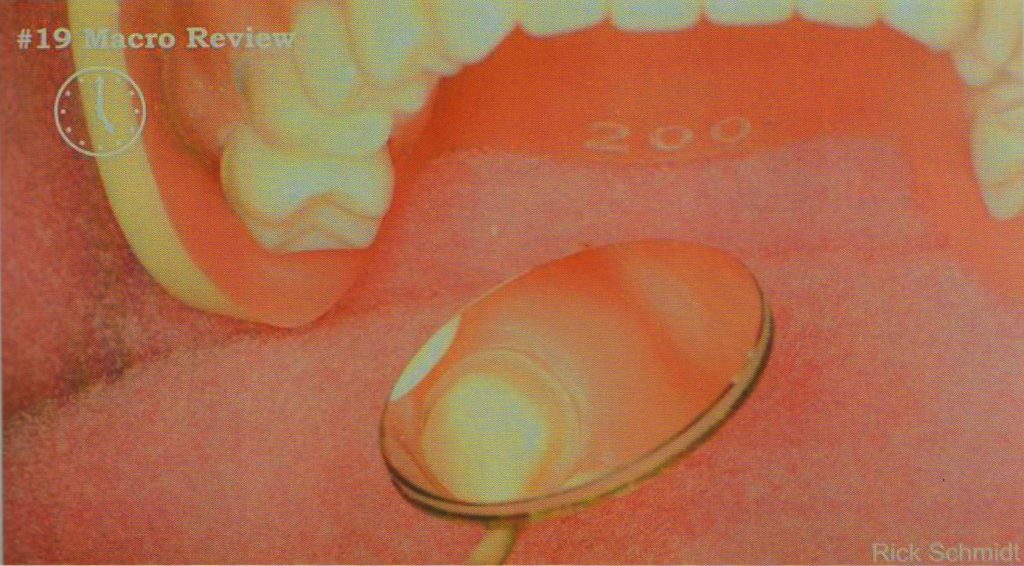 森川精密|左下后牙区的工作体位及口镜使用技巧 - 显微讲堂 - 24